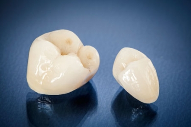 Răng sứ Zirconia 